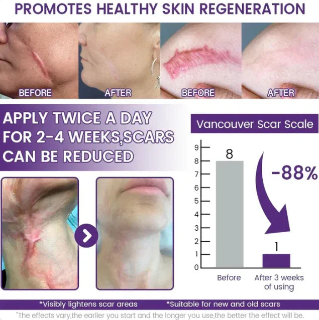 ReGenScar Stem Cell Repair Gel (Visible Scar Improvement in 7 Days)