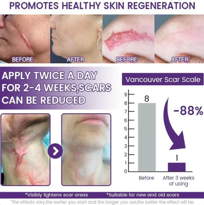 ReGenScar Stem Cell Repair Gel (Visible Scar Improvement in 7 Days)